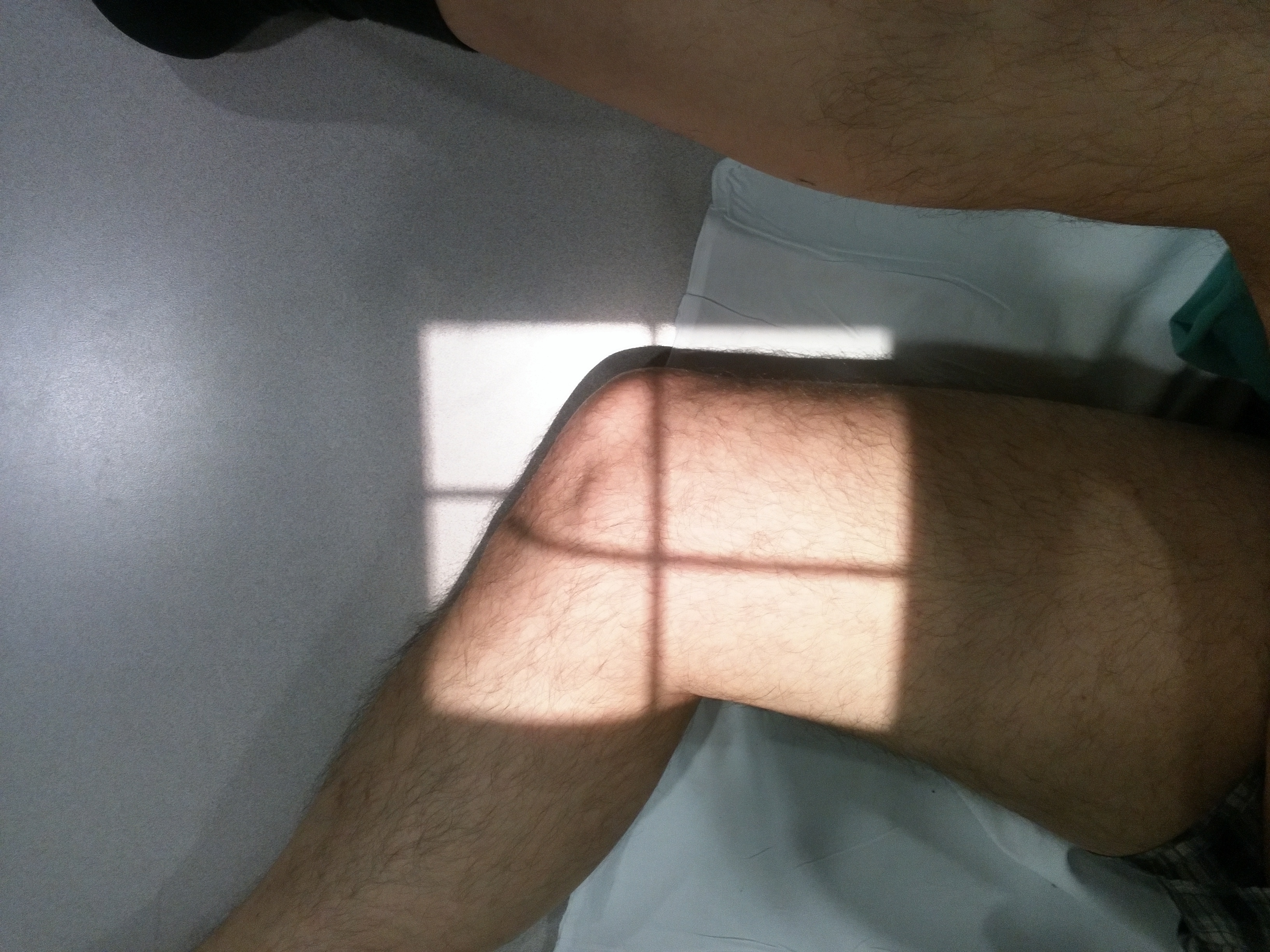 Proyección Lateral de Rodilla